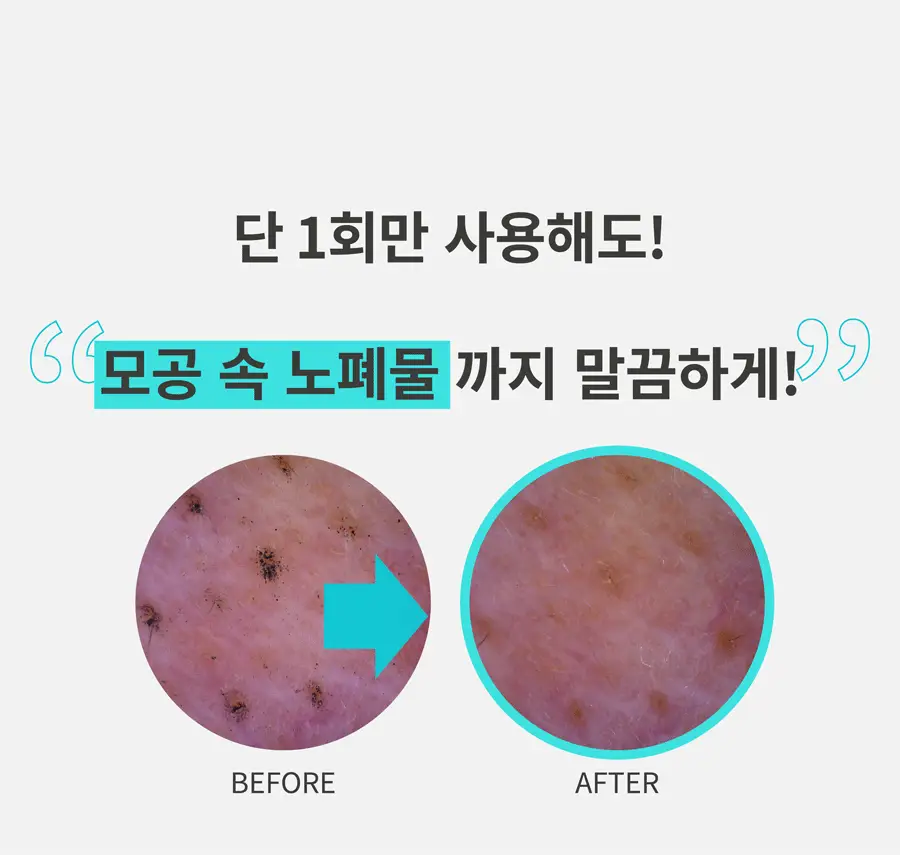 [1+1/모든 원료 비건] 포인트앤 딥 클린 휩 클렌징 폼 120g 1+1 기획 상세페이지 9